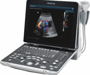 ECHOGRAPHIE DOPPLER COULEUR , PORTABLE 3 SONDES